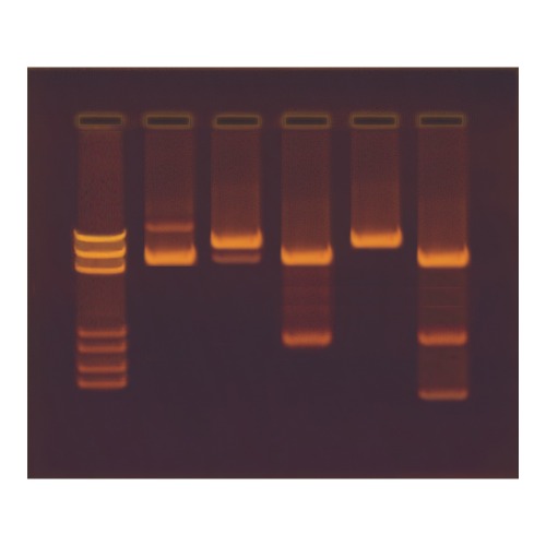 DNA 재조합의 설계와 복제