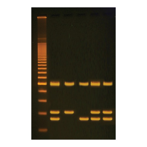 PCR을 이용한 유전자 변형 식품(GMO)의 구별